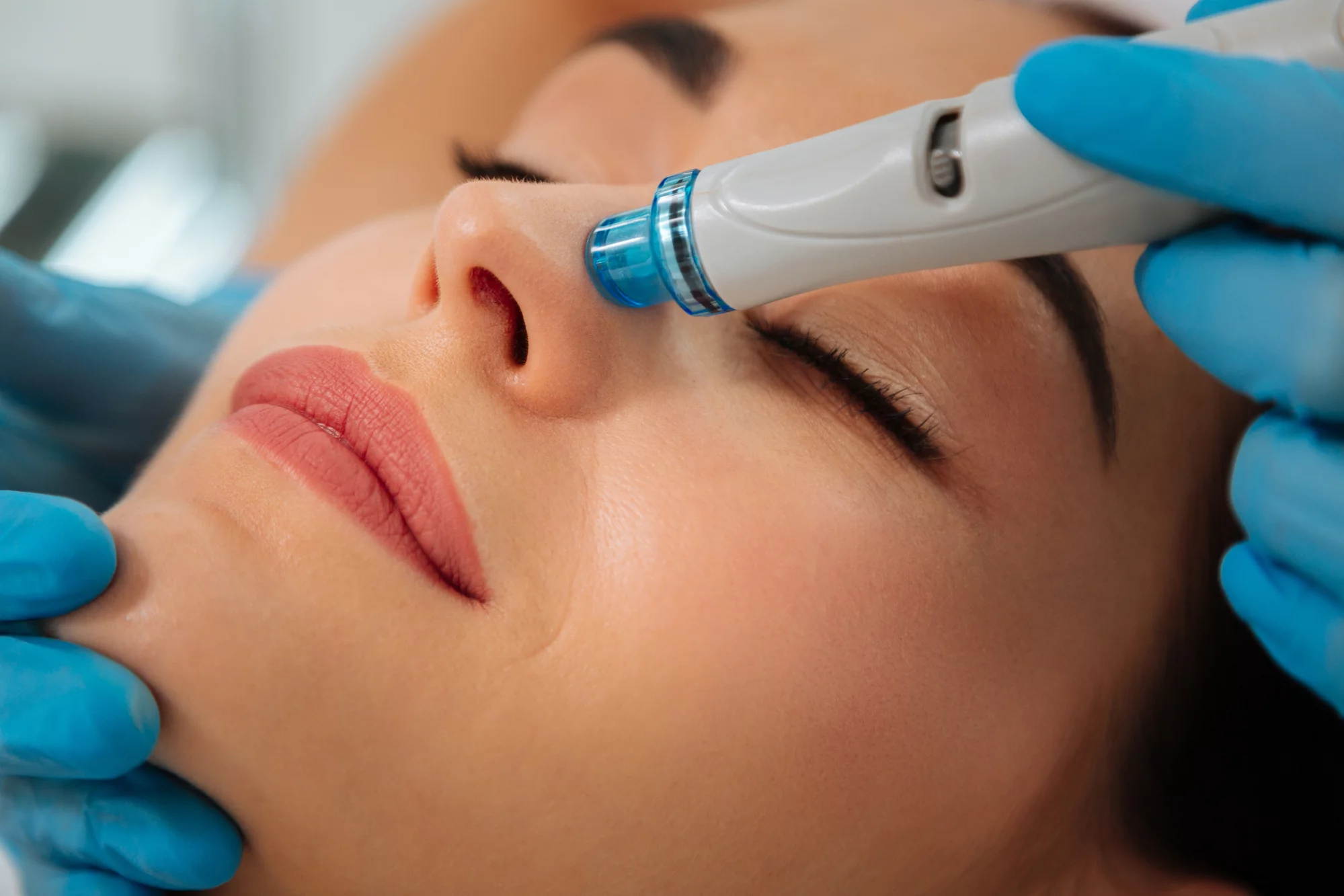 HydraFacial: The Ultimate Skin Rejuvenation Treatment